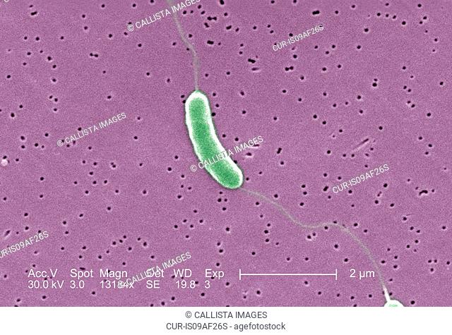 SEM of Vibrio vulnificus bacteria