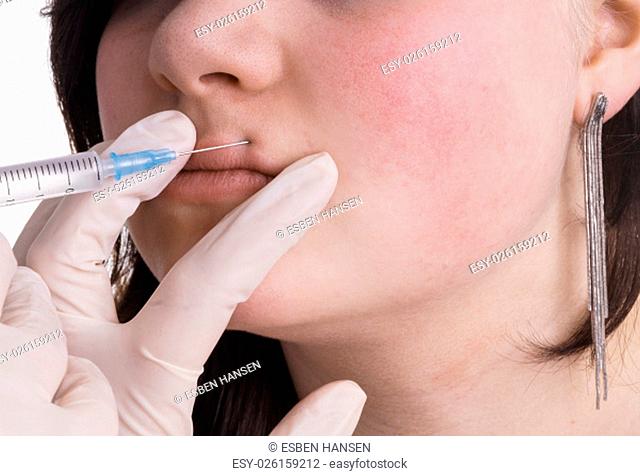 Young lady gets botox , filler or vitamin injection in the upper lip . She undergoes treatment by a professional beauty therapist or health care professional