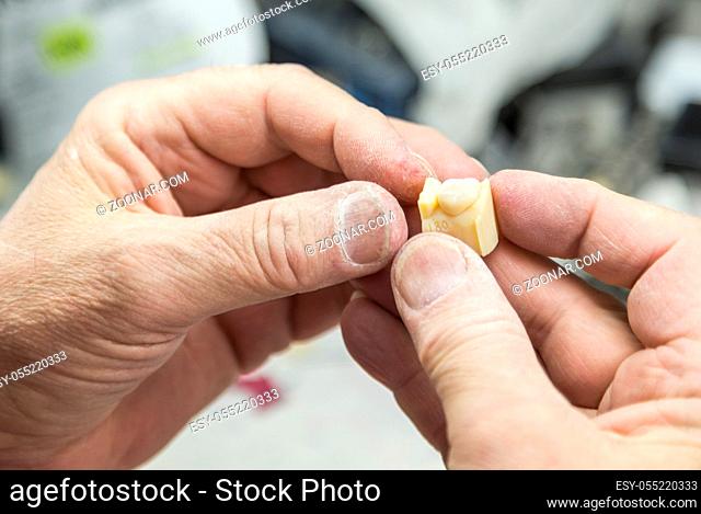 Male Dental Technician Working On A 3D Printed Mold For Tooth Implants In The Lab