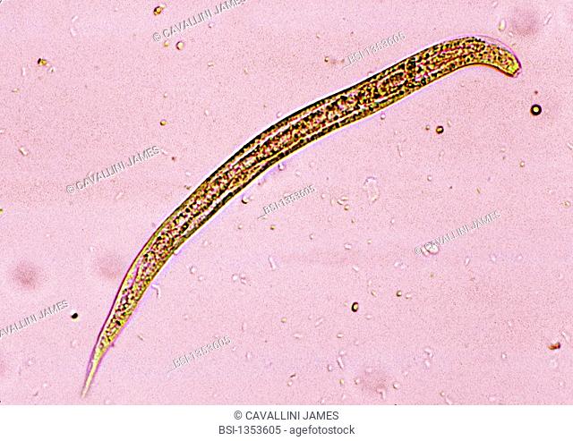 ANGUILLULA<BR>Anguillula, an intestinal parasite which is the causative agent of strongyliasis. Microscopic image (400X)