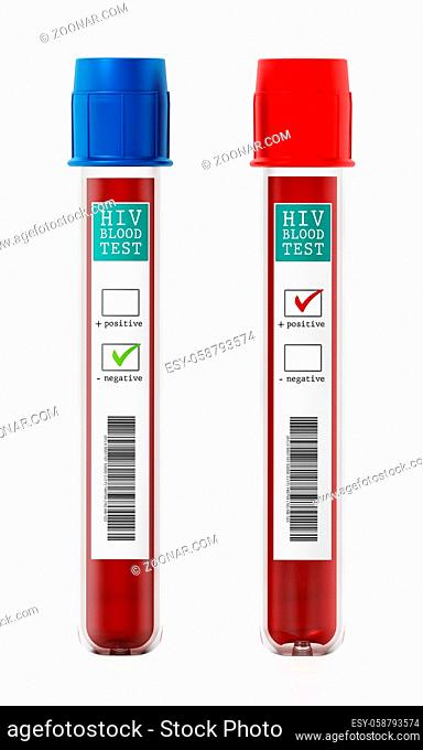 Positive and negative blood samples in vials with HIV test labels. 3D illustration