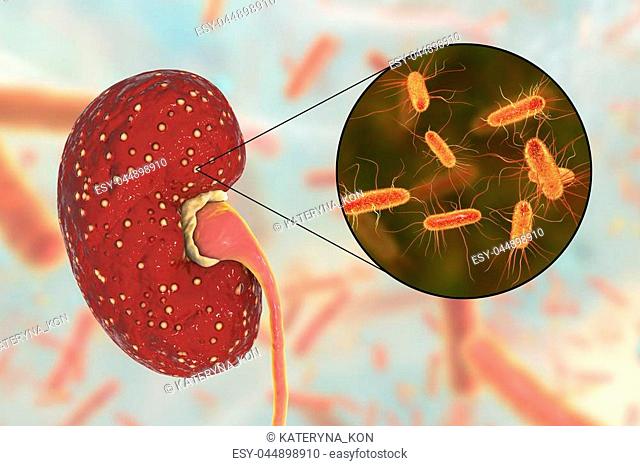 Acute pyelonephritis, medical concept, and close-up view of bacteria Escherichia coli, the common causative agent of kidney infection, 3D illustration