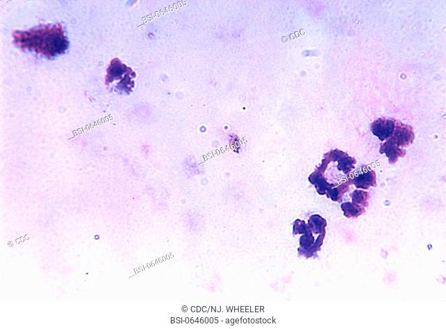 PLASMODIUM FALCIPARUM MALARIA<BR>This blood smear photomicrograph reveals a Plasmodium falciparum gametocyte. There are approximately 156 named species of...