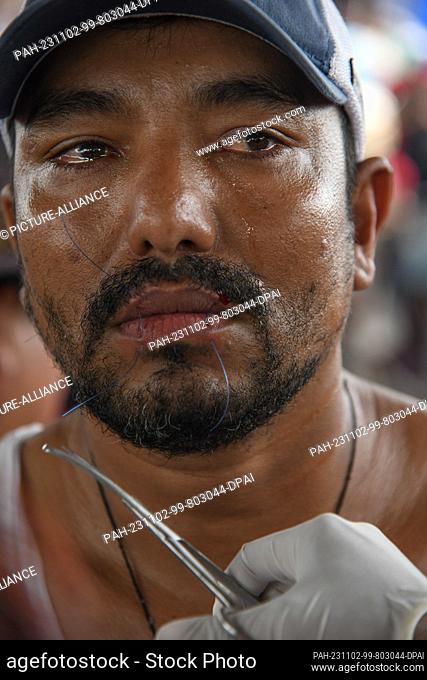 02 November 2023, Mexico, Huixtla: Marvin Barahona from Honduras has his lips sewn shut during a protest. In the municipality of Huixtla, Chiapas