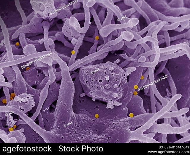 Scanning electron micrograph of Crimean-Congo hemorrhagic fever (CCHF) virus particles (yellow) budding from the surface of cultured epithelial cells from a...