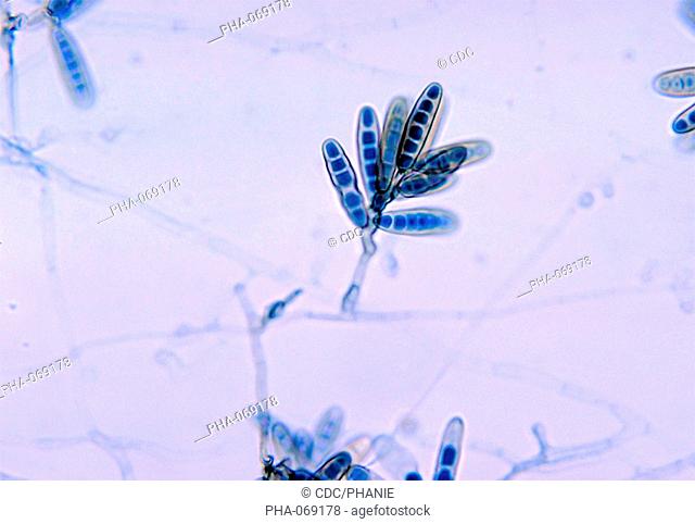 Light micrograph showing the conidia of the fungus Bipolaris hawaiiensis. The fungi Bipolaris are responsible for fungal illness phaeohyphomycosis