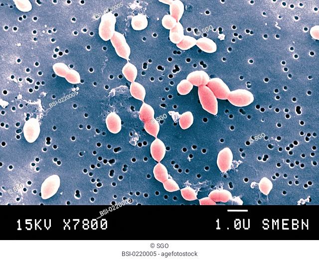STREPTOCOCCUS PNEUMONIAE<BR>Pneumococcus or streptococcus pneumoniae is a common host found in the mucosa of the mouth and pharynx