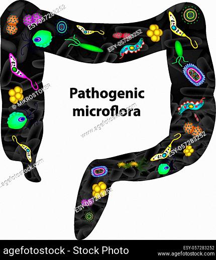 bacteroides spp a férfi kenetben orvosi paraziták kezelése