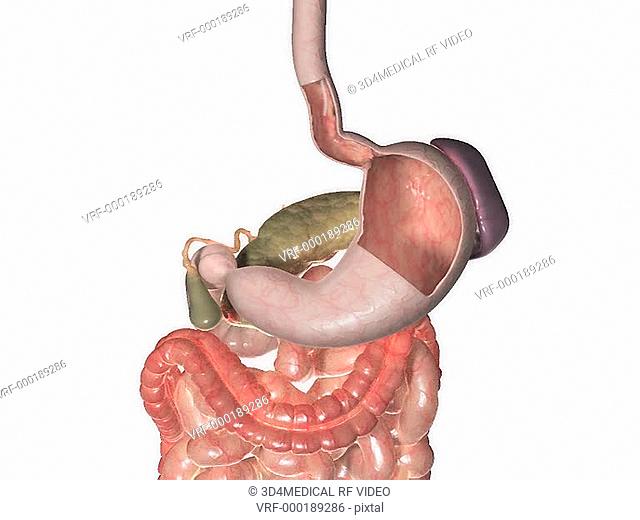A zoom in on a gastric feeding tube entering the stomach, which is sectioned, via the lower esophageal sphincter or LES which then, over time