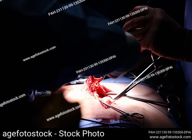 PRODUCTION - 29 November 2023, Schleswig-Holstein, Rendsburg: Two doctors perform an abdominal operation in the Schön Klinik's surgery center