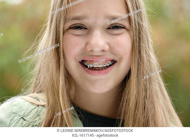 Teenager girl with dental braces