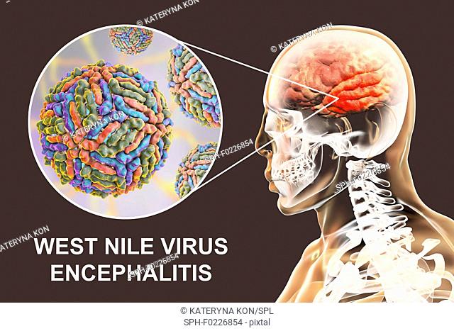 Encephalitis caused by West Nile virus, illustration