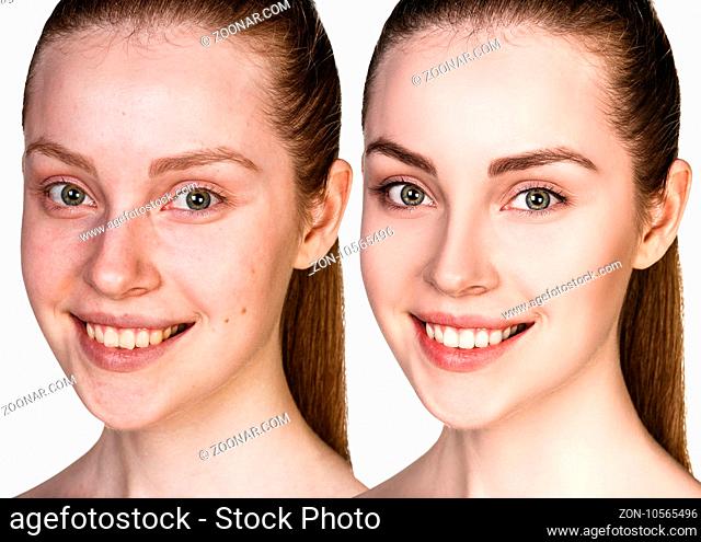 Comparison portrait of young woman without and with makeup
