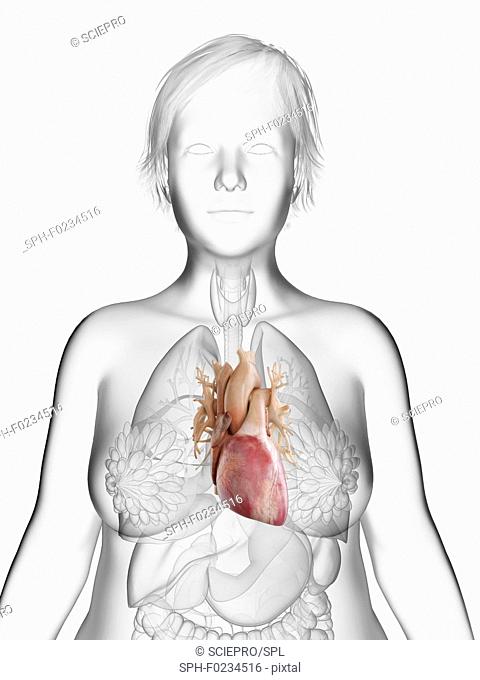 Illustration of an obese woman's heart