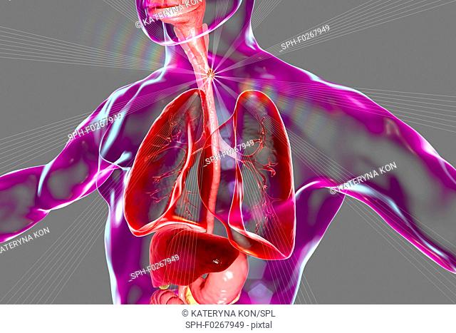 Oesophageal cancer, computer illustration