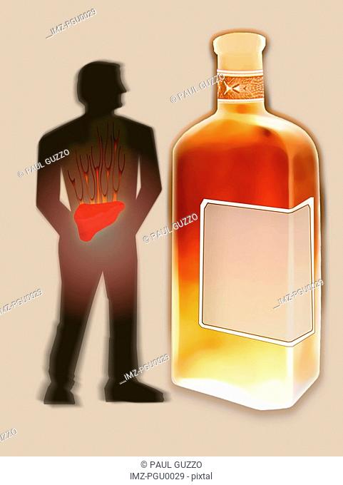 Man with highlighted liver standing next to large bottle of alcohol