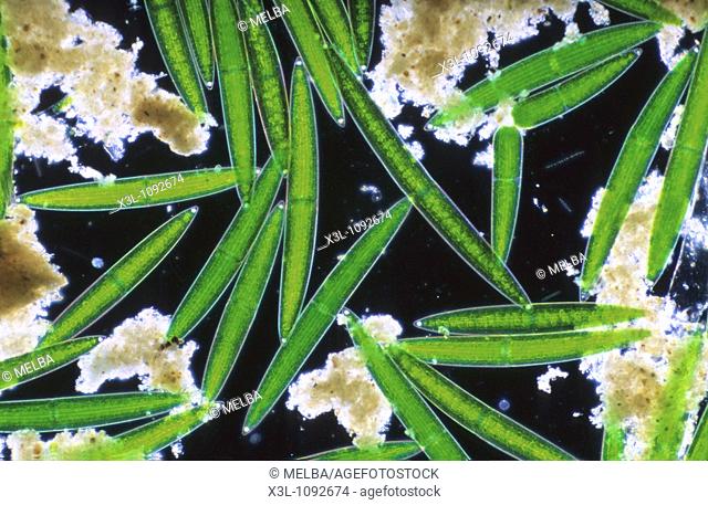 Closterium Chlorophyta Algae Optic microscopy