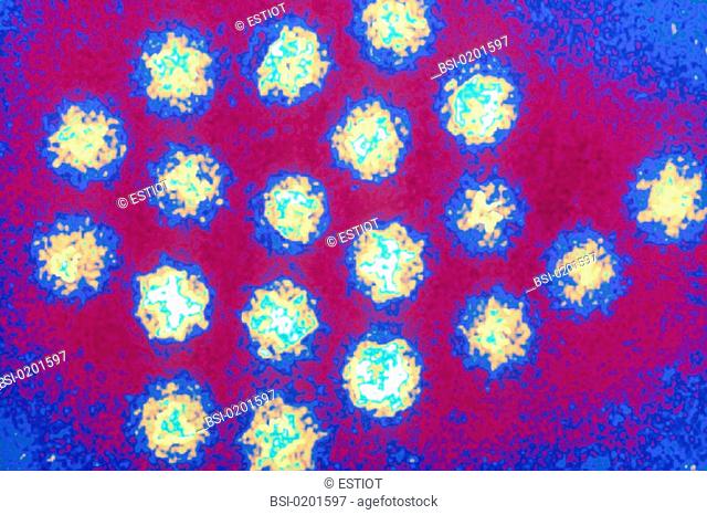 NORWALK VIRUS<BR>Norwalk virus, a parvovirus, causes gastroenteritis