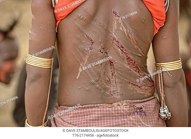 Hamer woman's back after being whipped at a bull jumping ceremony near Turmi in the Omo Valley, Ethiopia. The young women taunt the men into hitting them harder