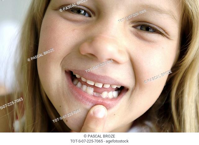 Portrait of a girl showing her missing tooth