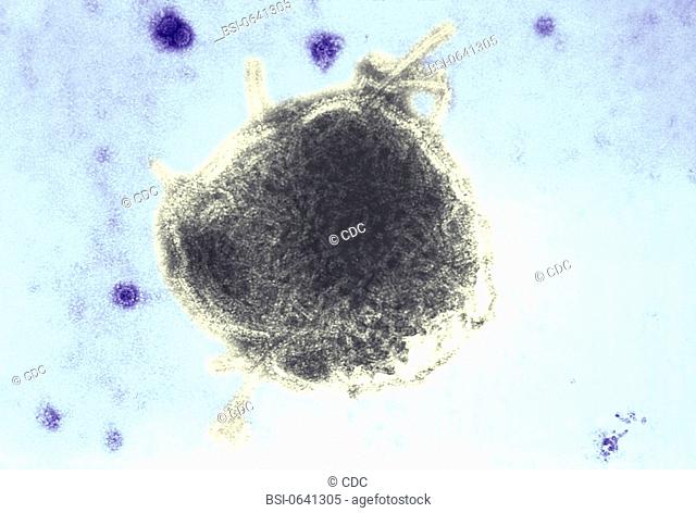 PARAMYXOVIRIDAE<BR>This electron micrograph reveals both a paramyxovirus measles virus, and virions of the polyomavirus, simian virus SV40 (smaller circles)