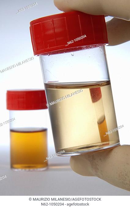Urine in tube prepared for testing