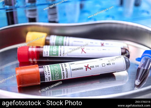 Blood sample from Ebola patient, positive result, conceptual image