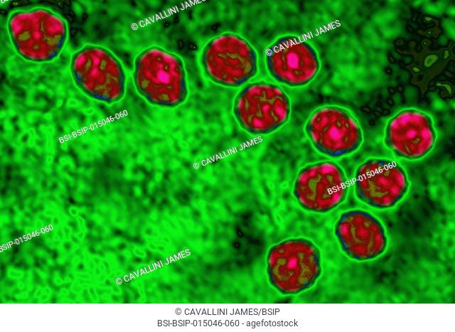 Zika virus. It is an arbovirus, a member of the Flavivirus family and the Flavivirus genus. Seen by transmission electron microscopy (viral diameter 40 nm)