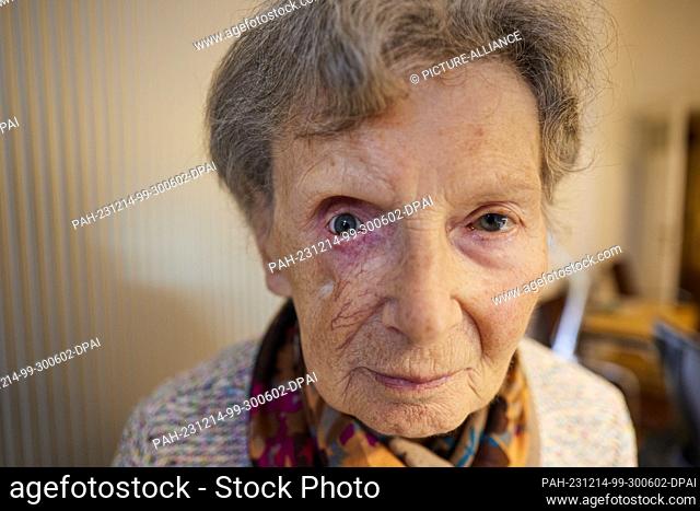 PRODUCTION - 14 December 2023, Berlin: 86-year-old Doris Zimmermann wears a prosthetic eye on the right (left from the viewer's perspective)