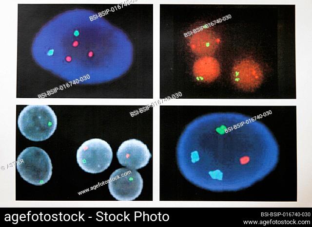 Cytogenetics laboratory, prenatal diagnosis by medical imaging FISH (Fluorescent In Situ Hybridization / Hybridization par Fluorescence In Situ)