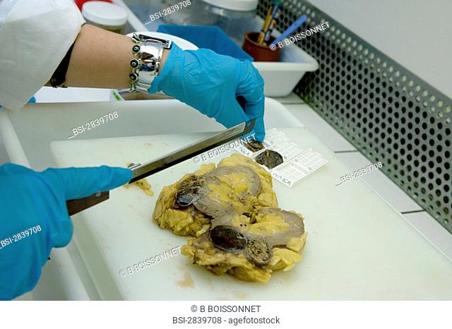Photo essay from hospital. Photo essay from hospital. Hospital of Meaux 77, France. Laboratory of anatomical pathology. Preparation of an anatomical specimen :...