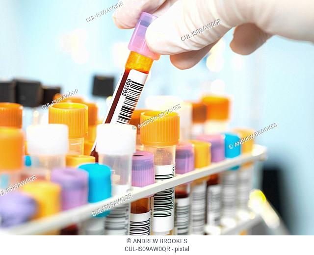 Laboratory technician preparing blood sample for medical testing in laboratory