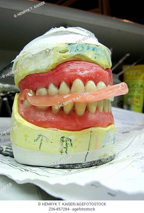 Denture model