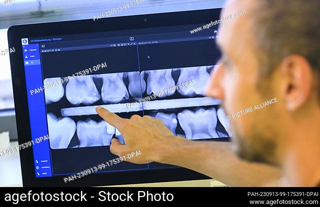 PRODUCTION - 11 September 2023, Lower Saxony, Hanover: A pediatric dentist views an X-ray of a child's deciduous molars in a pediatric dental office