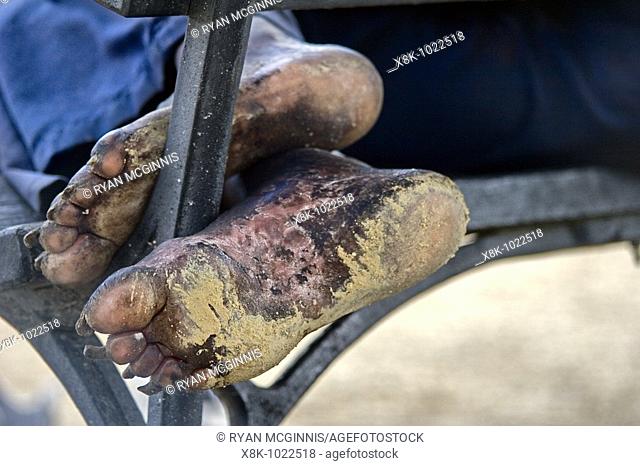 The feet of a homeless man sleeping on a bench at the National Mall in Washington D C