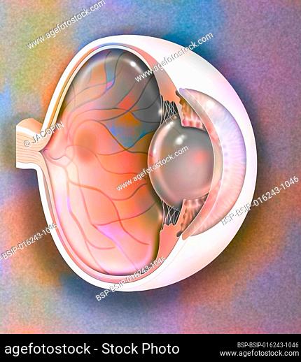 Sagittal view of the eye anatomy showing lens, retina, cornea, iris, choroid