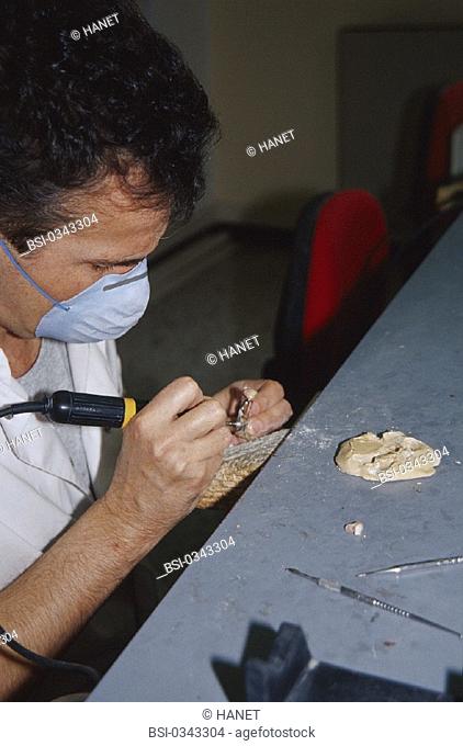 DENTURE FITTER<BR>Photo essay.<BR>Prosthetist, with small carving machine, used for all polishing and sculpting work