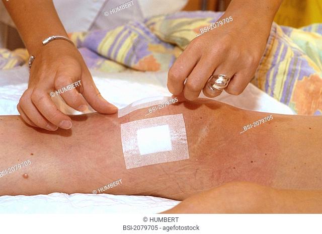 BANDAGE<BR>Photo essay from hospital. Patient and nurse.<BR>Photo essay at Antony private Hospital, France (92). Department of orthopedics