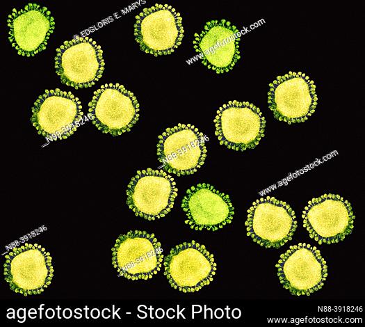Purified coronavirus Covid-19 particles under transmission electron microscopy (TEM)