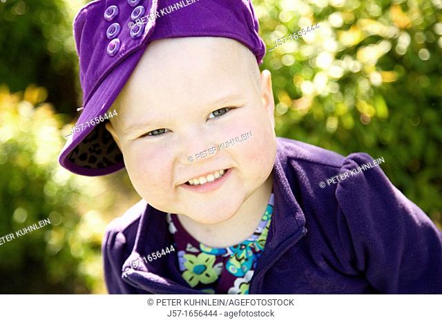 Portrait of a young girl with pediatric cancer leukaemia smiling at the camera  She has just lost her hair after a strong dose of chemo therapy but is still...