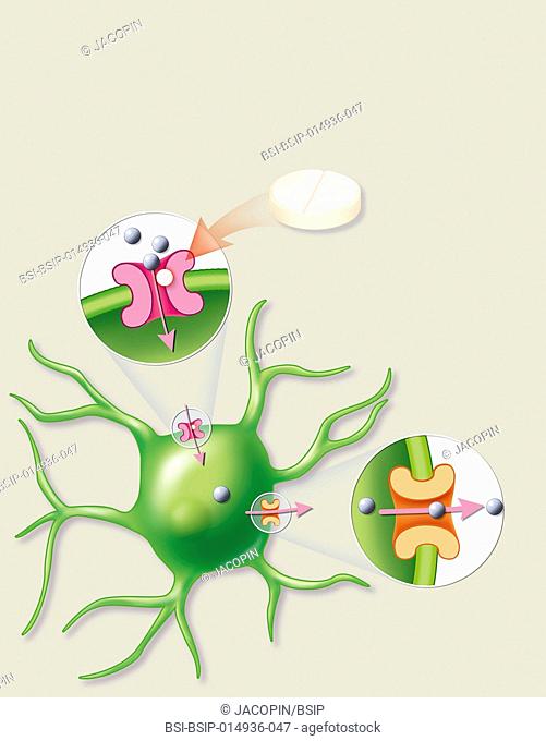 Illustration of the action principal of a diuretic used in treating autism. The pill lessens the entry of chloride into the neurons by blocking the NKCC1 pump