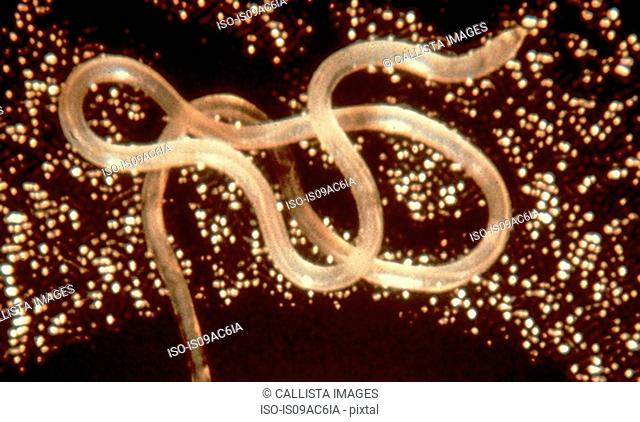 Loa loa roundworm, the cause of Loa loa filariasis