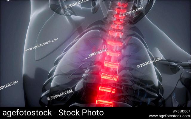 Hurt Spine. Male Backbone. Backache, Headache - Vertebrae Pain