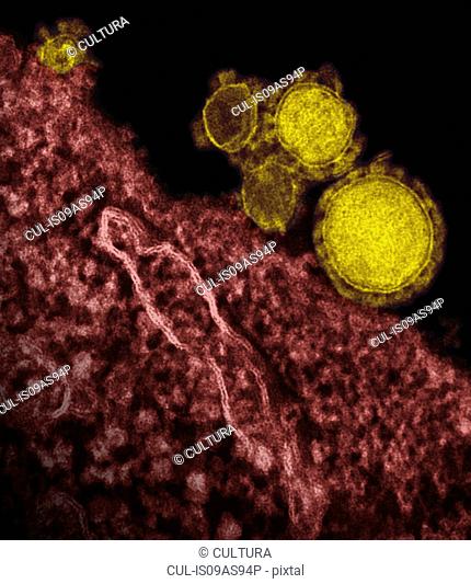 Colorized transmission electron micrograph (TEM) showing five spherical-shaped Middle East Respiratory Syndrome Coronavirus (MERS-CoV) virions, colorized yellow