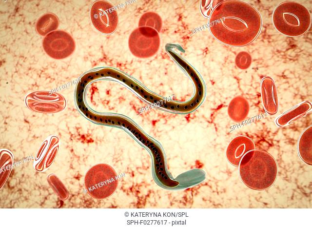 Wuchereria bancrofti parasite, illustration