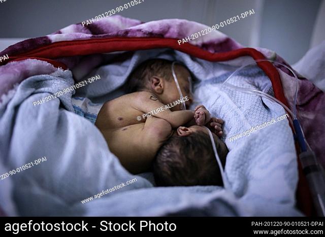 20 December 2020, Yemen, Sanaa: Conjoined twin male babies undergo a magnetic resonance imaging (MRI) at al-Sabeen hospital in Sanaa