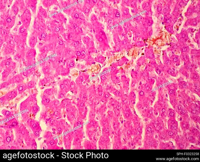Human liver tissue, light micrograph