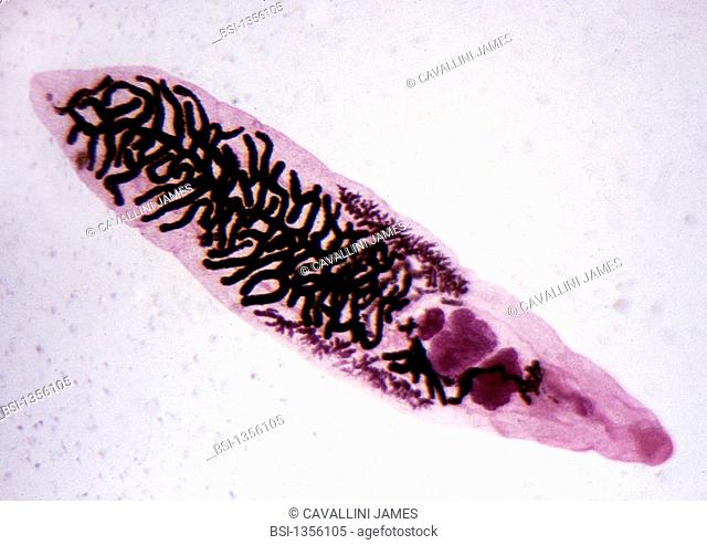 FLUKE<BR>The fluke is a parasitic, hermaphroditic flatworm, and the causative agent of distomatosis. Microscopic image (200X)