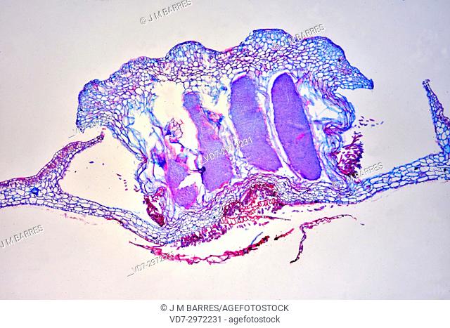 Marchantia antheridium. Optical microscope X 40