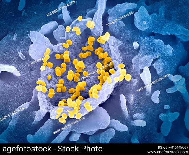 This scanning electron microscope image shows SARS-CoV-2 (round gold particles) emerging from the surface of a cell cultured in the laboratory